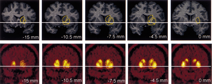 Nature_ventral_striatum.jpg