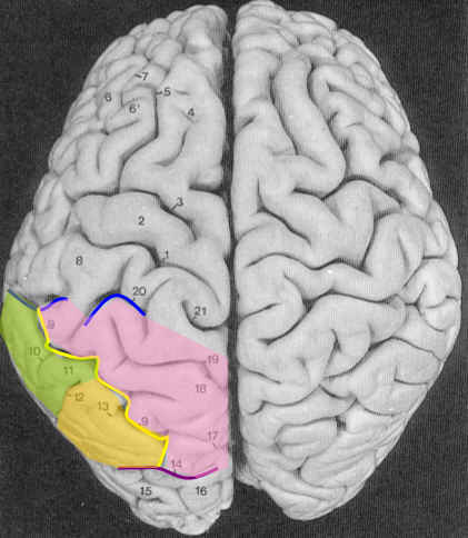 intraparietal_axial.jpg