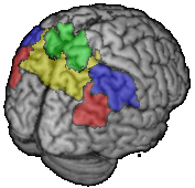 parietal_rend_posterior45.png