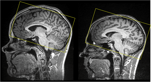 typicalbrains.gif