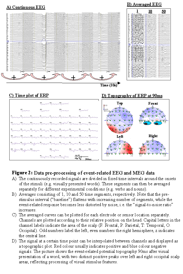 EEGpreprocessing.gif