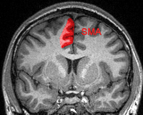 sma_coronal.png