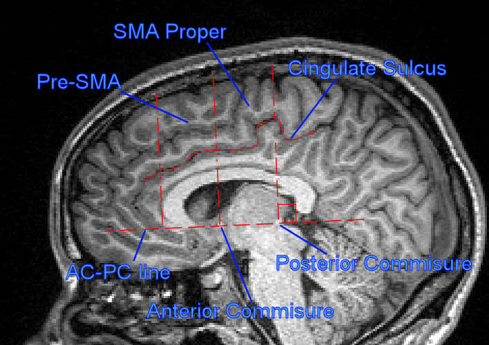 sma_sagittal.png